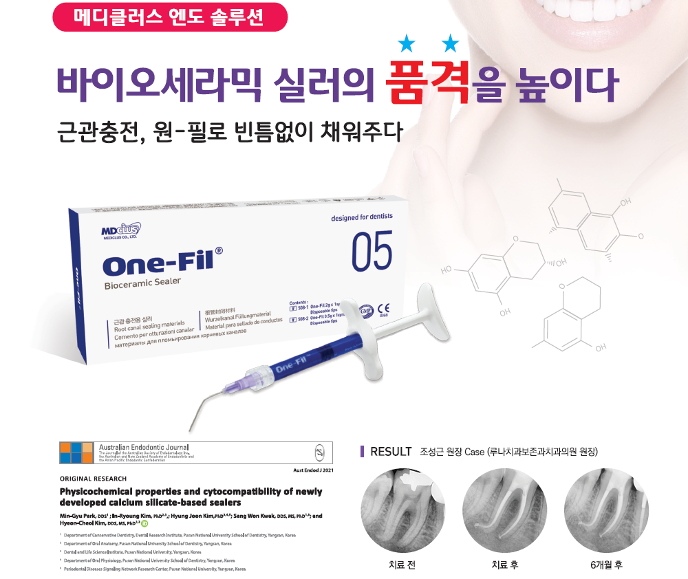 One-Fil Bioceramic Sealer (근관 충전용 실러)